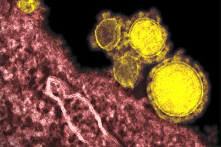 First case of Coronavirus confirmed in UAE