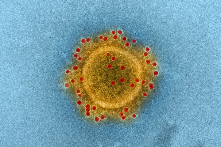 Coronavirus, infected, dead, healthy, Bangladesh Coronaviruskəˈrōnəˌvīrəs