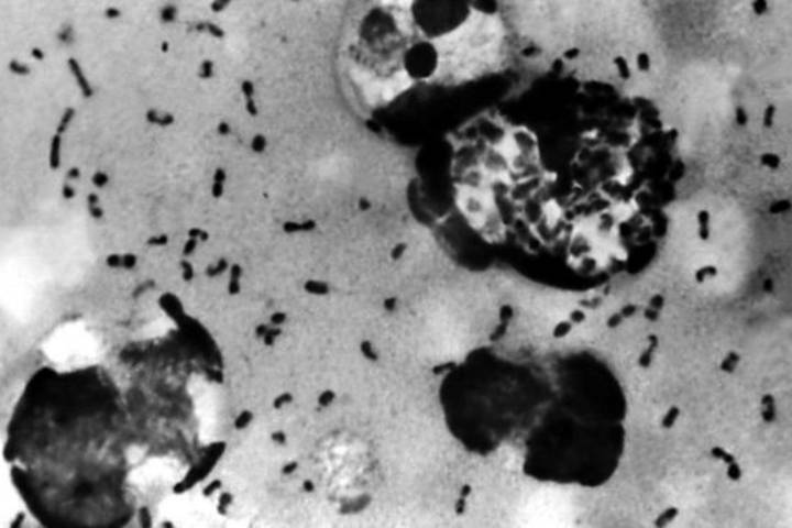 suspected case of bubonic plague found in chinas inner mongolia