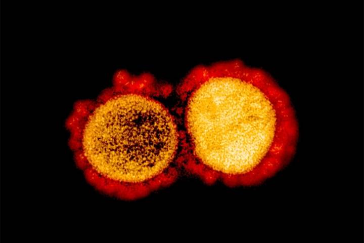 Malaysia detects new coronavirus strain that is ten times more infectious