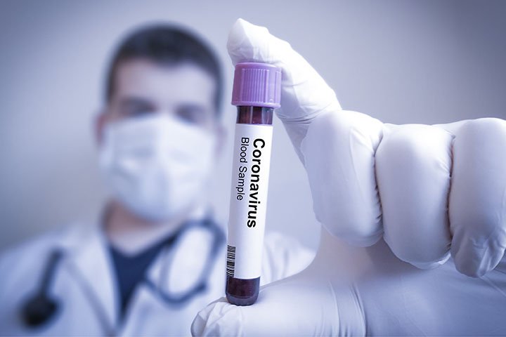 Coronavirus test
