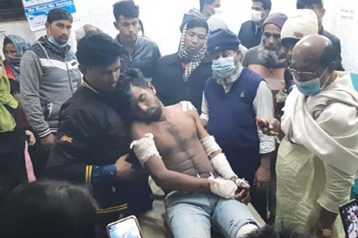 In Madaripur, 5 people including women were injured in the attack of the opponent due to the previous hostility