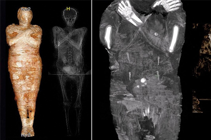 In a First, Researchers Discover a Pregnant Egyptian Mummy